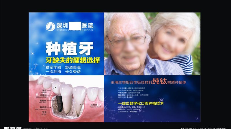 单颗种植牙，如何选择更长寿的品牌？**